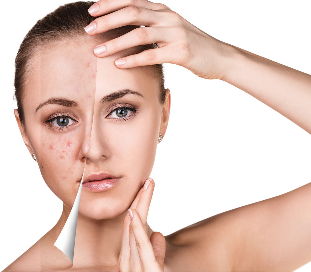 Woman,Face,Before,And,After,Retouch