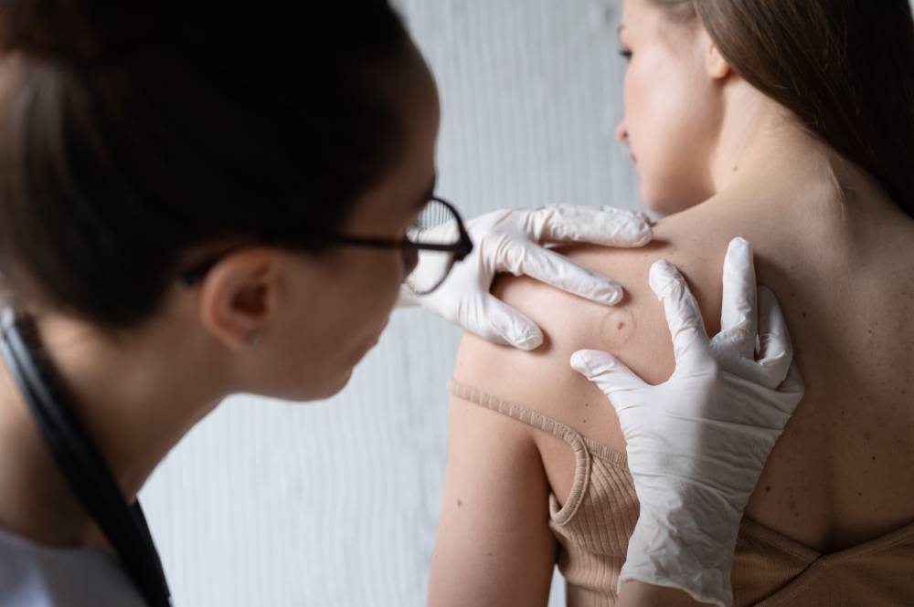 wart-removal (1)
